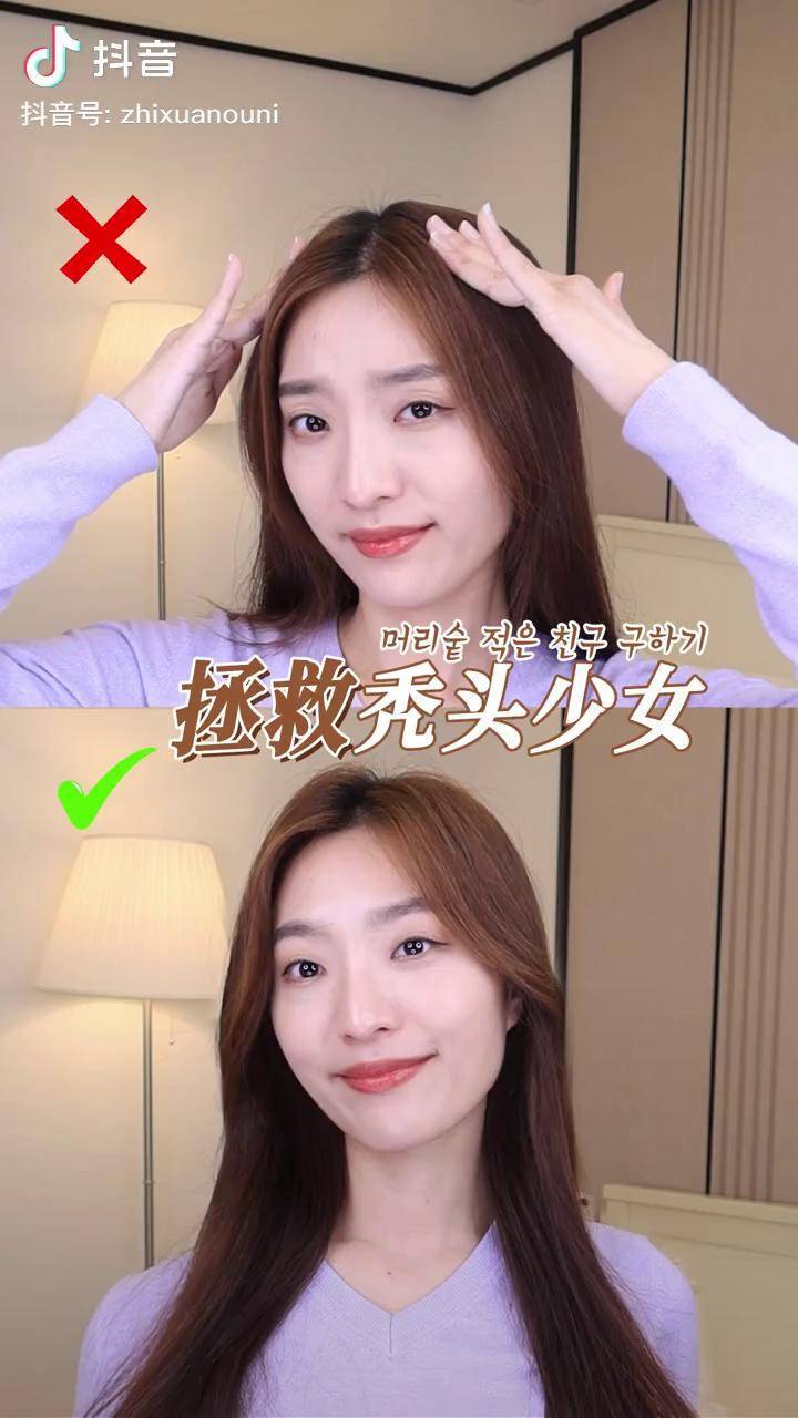 3招徒手分发缝技巧让秃头少女秒变发量富翁发缝韩国防脱大咖克洛特