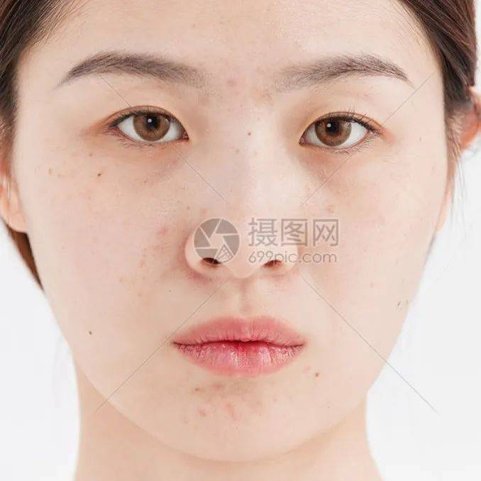 【金牌医生】春季这些常见的皮肤损伤,如何应对?_皮损_长春市_科普大