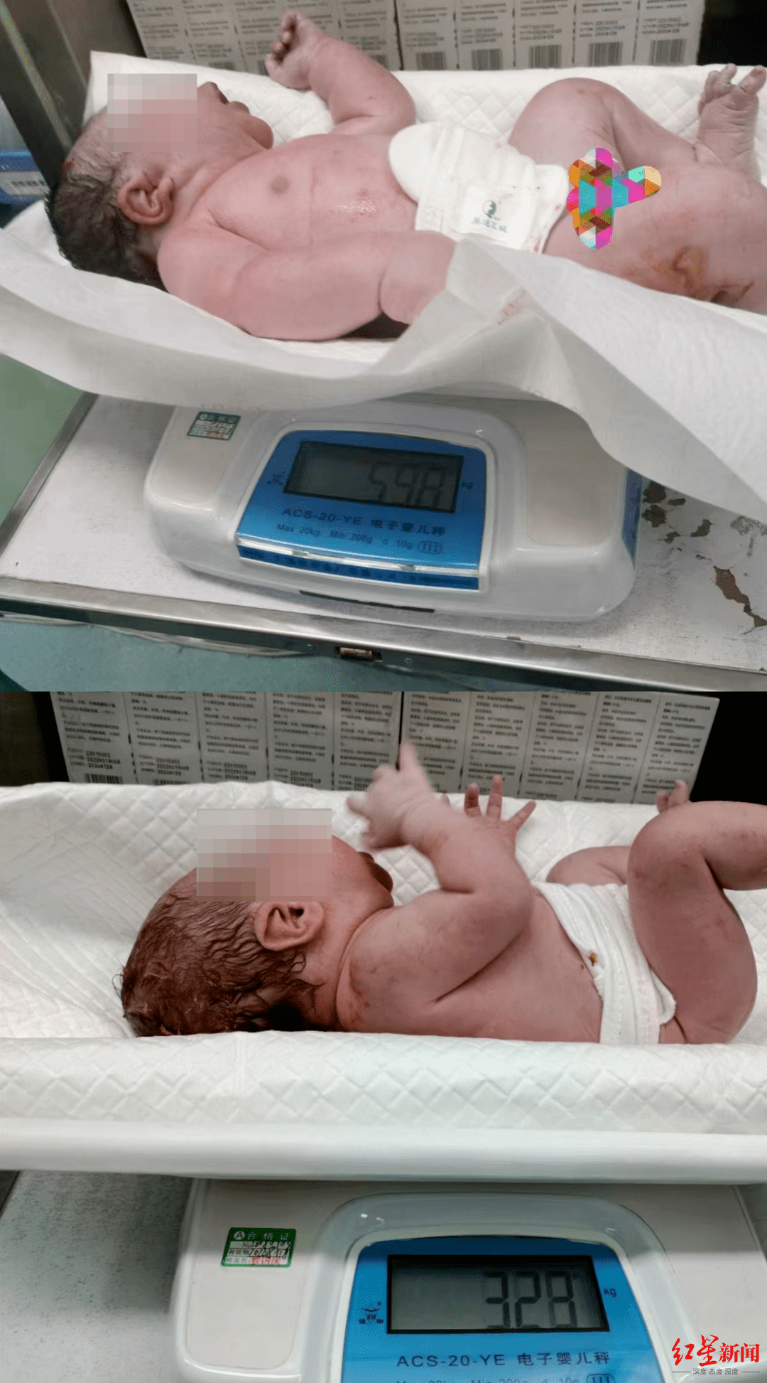 11.96斤！成都一巨型婴儿降生 医生提醒：孕期体重管理或决定孩子一生