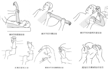 【康复园地】脑卒中后1-3个月内常发生这种病,康复治疗可避免残疾