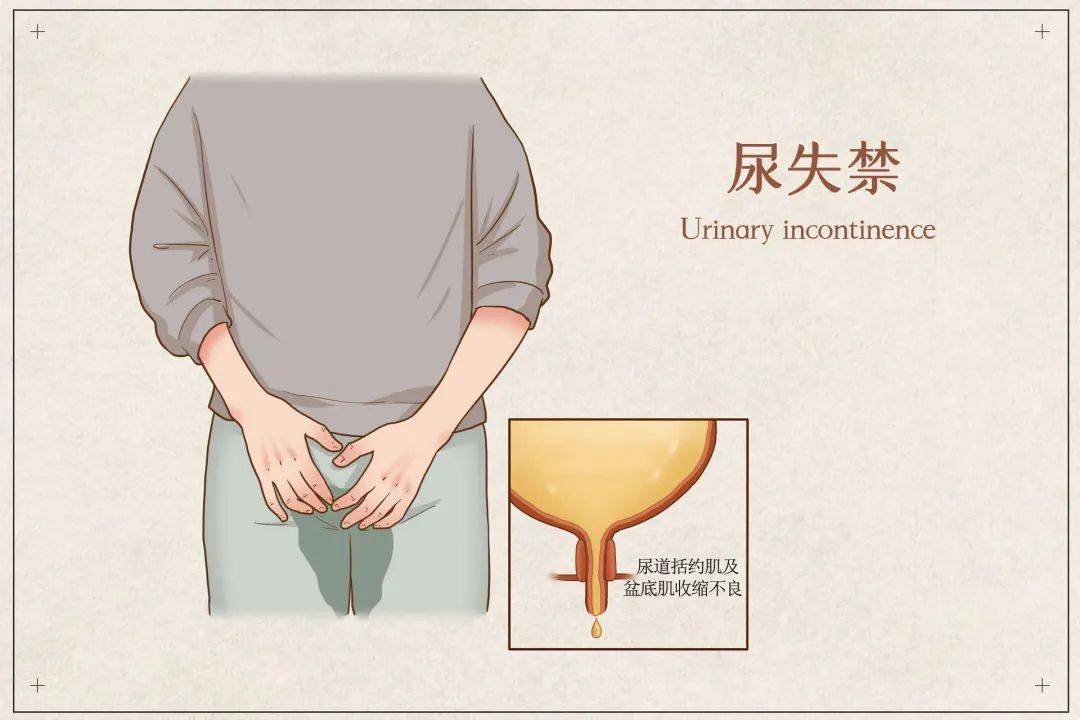 成年人的崩溃尿失禁了怎么办