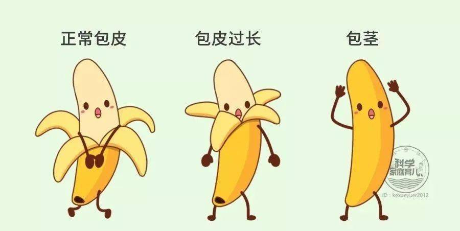 包皮的几种类型注:包皮上的红杠杠纯属虚构就像给丁丁穿了件高领毛衣