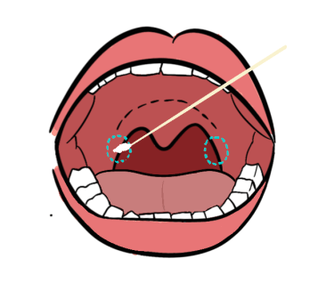 核酸检测嘴巴示意图图片