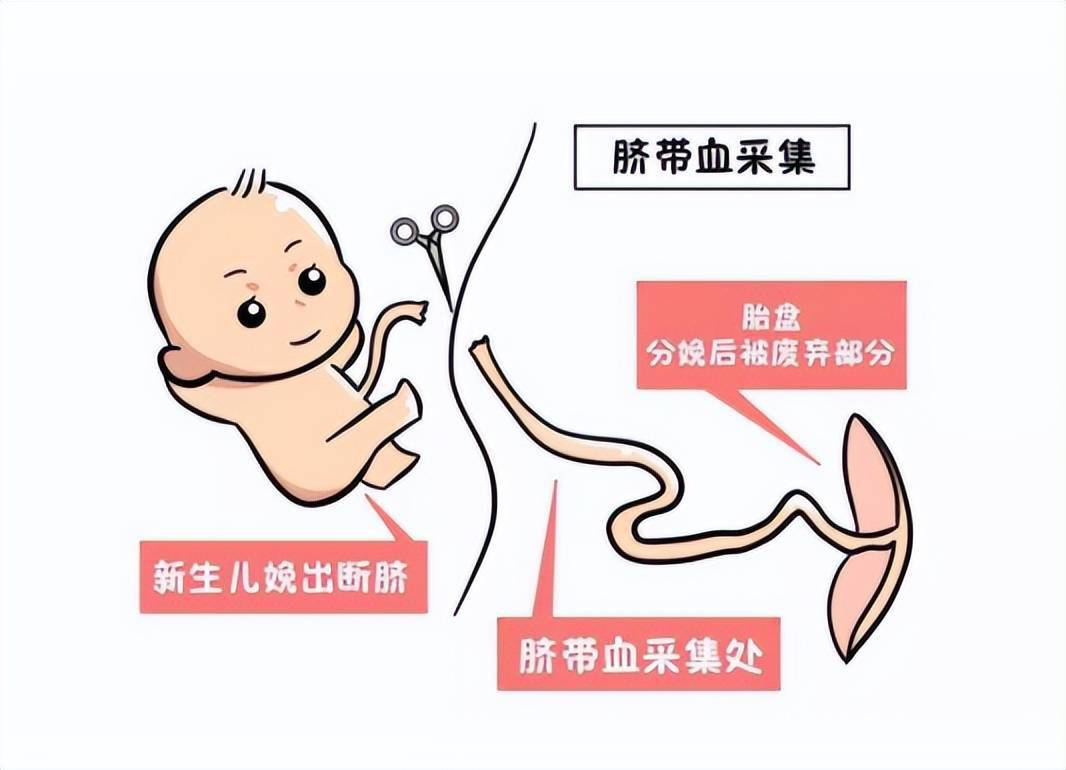 脐带血该不该存有没有用这篇文章解答你所有疑惑