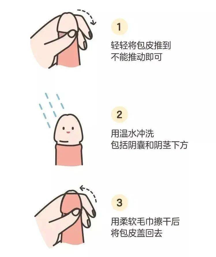 假如你有一个儿子,千万不要对他做这些_宝宝_男孩_包皮