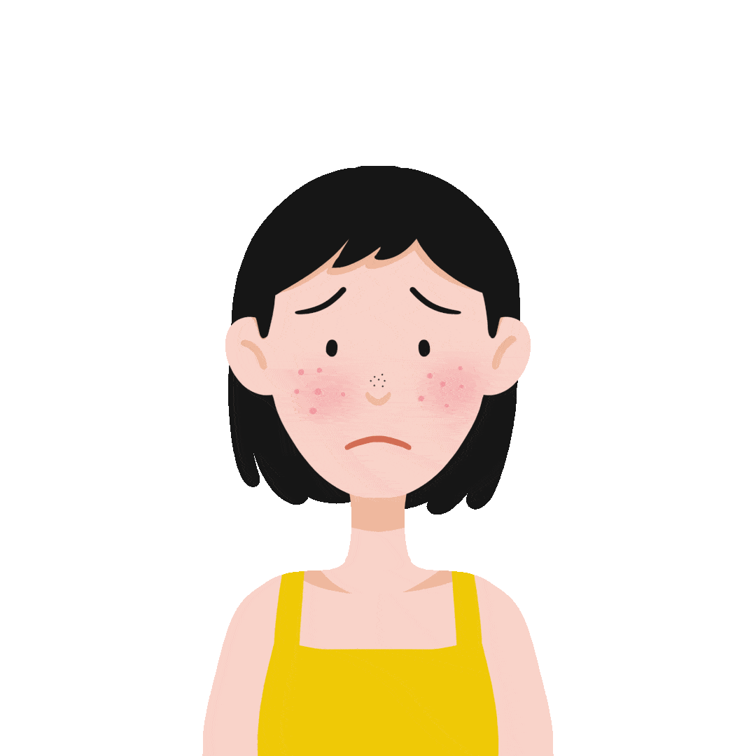 全国护肤日油光满面得了面部脂溢性皮炎该怎么办