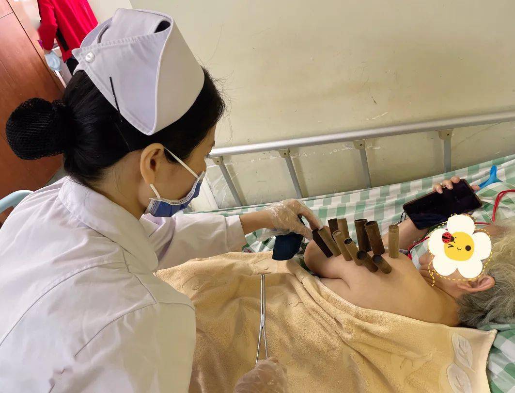 中医疗法中风恢复期肩痛难忍中医小小竹罐解决大问题特色康复疗法巧治