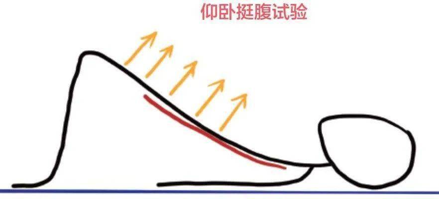 仰卧挺腹试验:扭腰到位了吗?