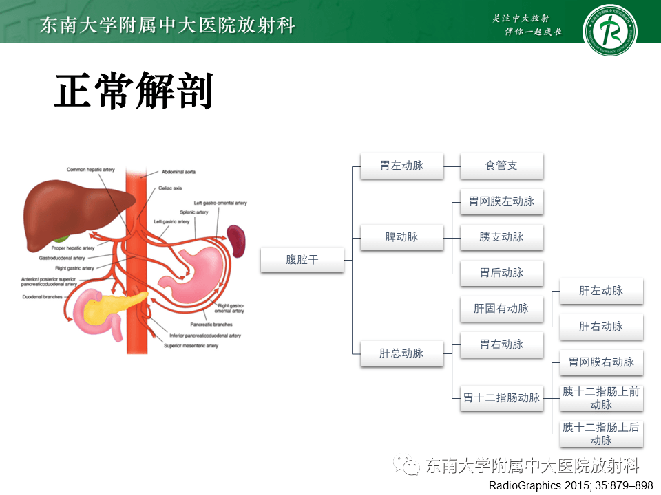 肝动脉变异