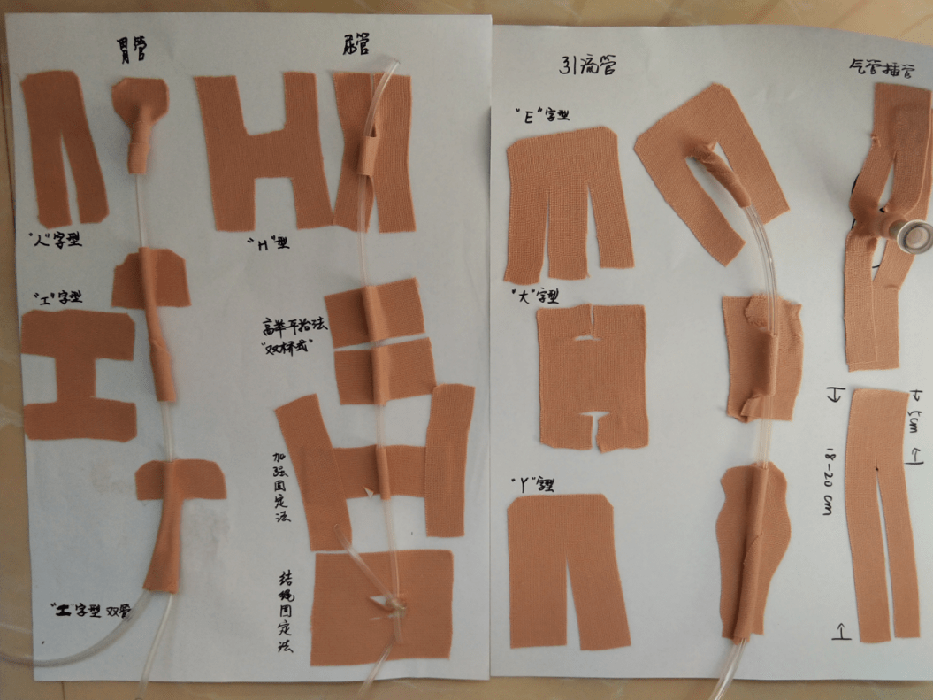 居然有人这样固定胃管,还好患者用嘴也能呼吸,一图搞定各种固定