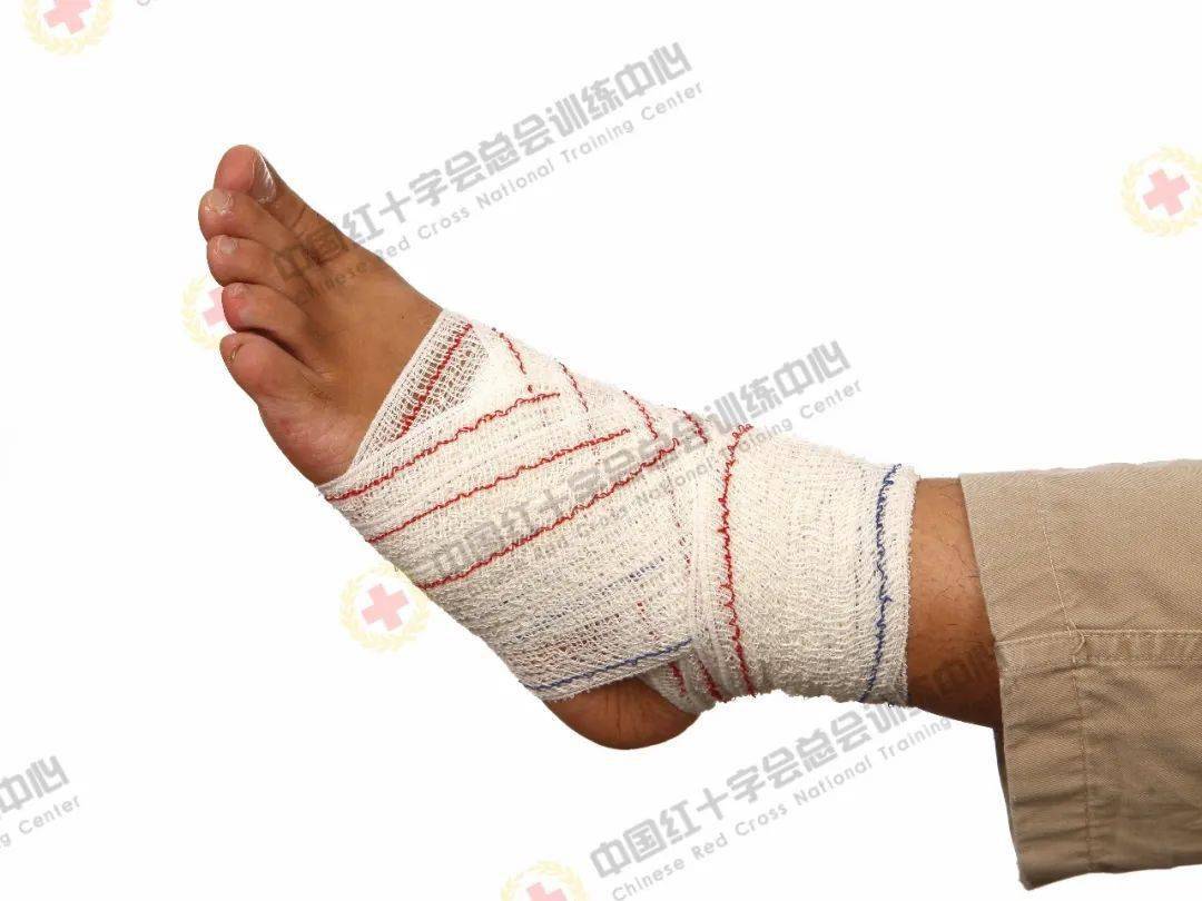 救在身边|现场包扎技术之绷带"8"字包扎_环形_肘关节_手背