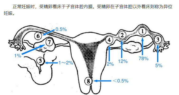 彩超提示:宫内未见孕囊,左附件区混合性包块,大量腹腔积液,子宫漂浮