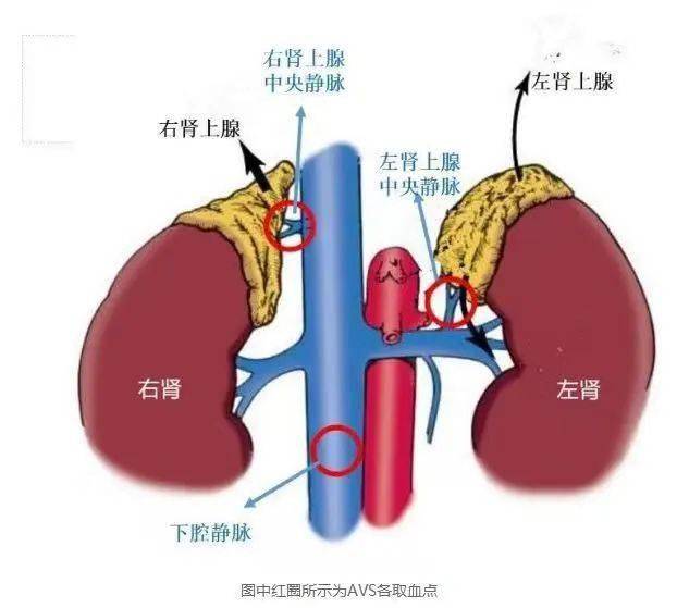 肾上腺血管解剖结构图图片