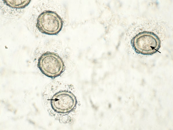 球蟲細胞學特點糞便中可見尚未分化成孢子的卵囊