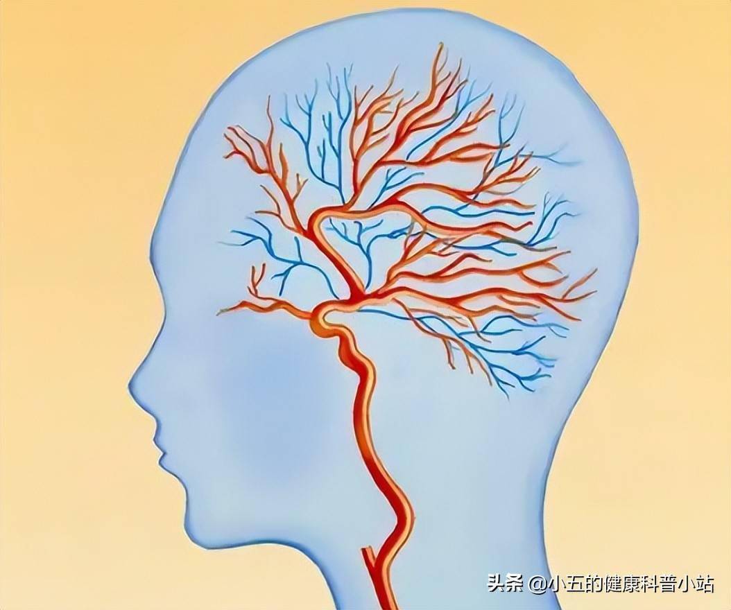注意脑供血不足的早期表现科学服用4种药物积极改善血液循环