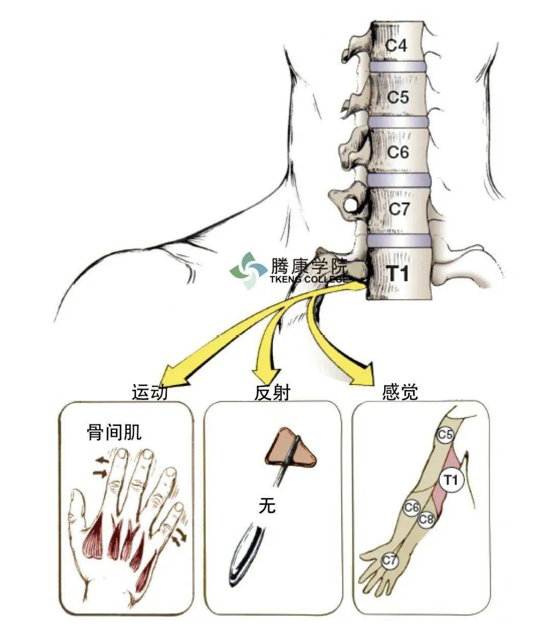 【總結】脊神經根損傷的評估:肌節,皮節和骨節_肌肉_平面_感覺