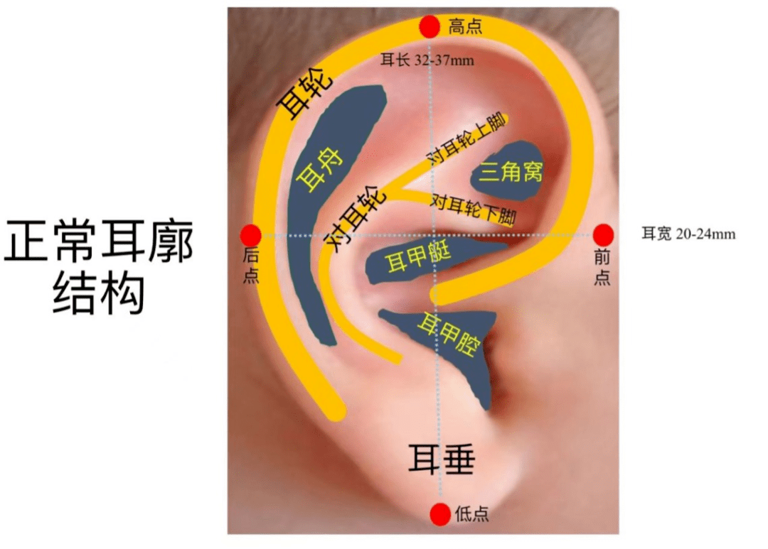 耳轮耳廓图解图片