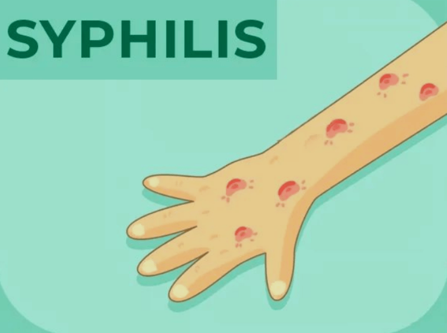 科普谈梅色变中的梅到底是什么