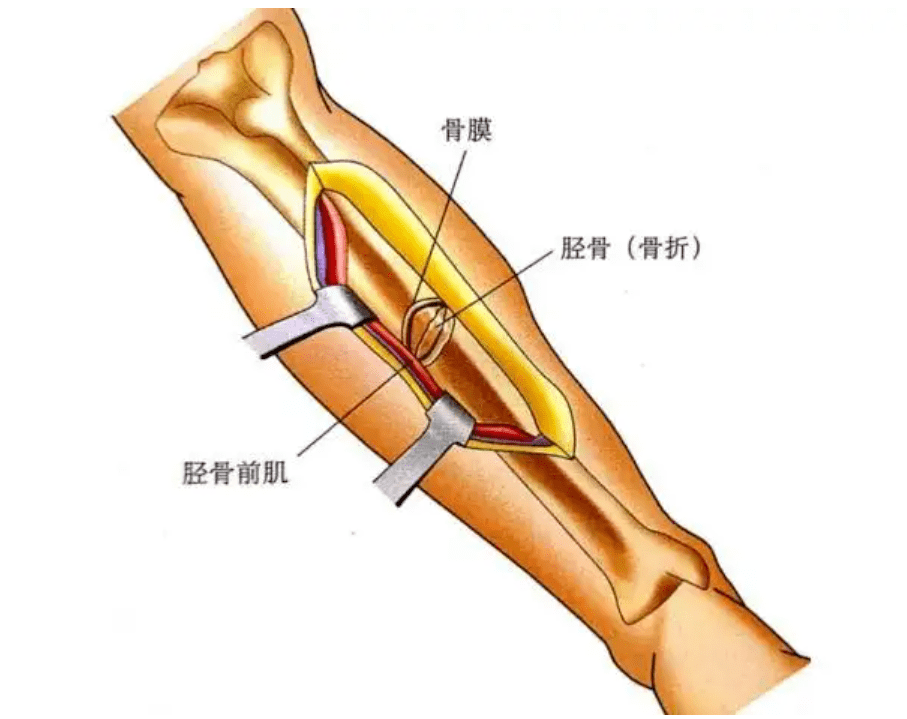 胫骨前肌解剖图图片
