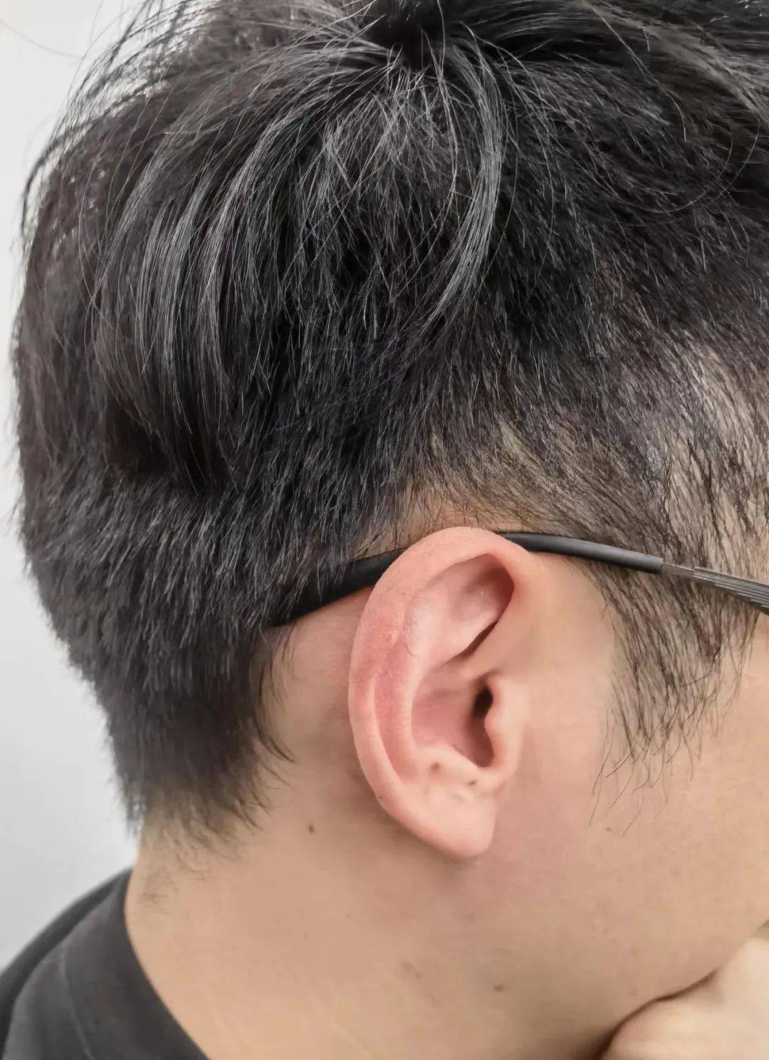 知名歌手左耳失聪这个习惯动作很多人都有一定要小心