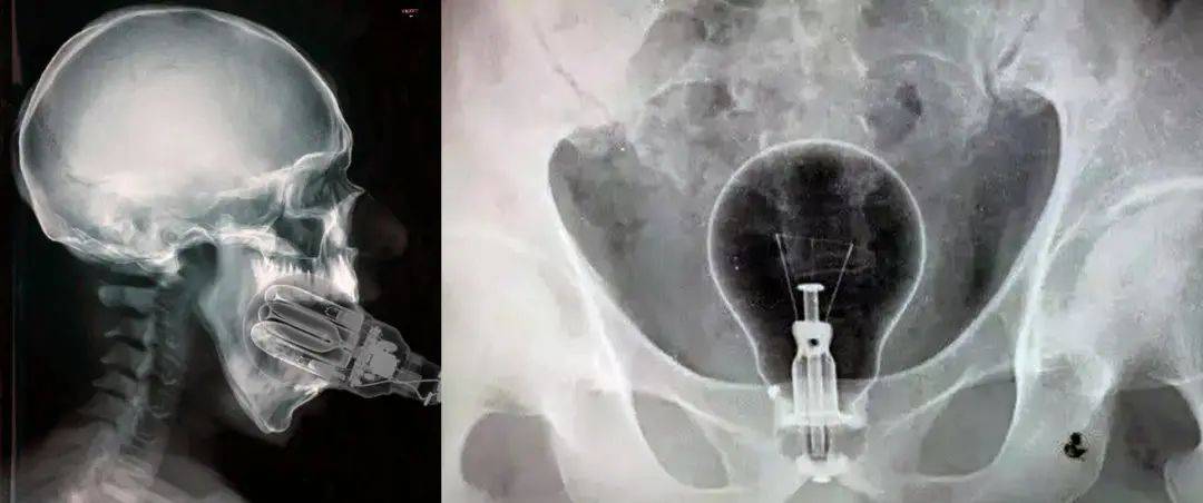 为什么男人总是不小心成变形金肛