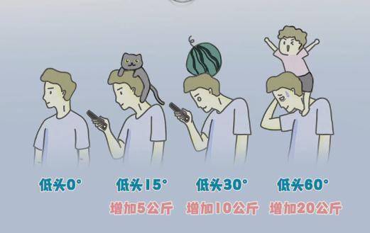 低头60度玩手机颈椎受力会增加相当于一个小朋友的体重真的吗