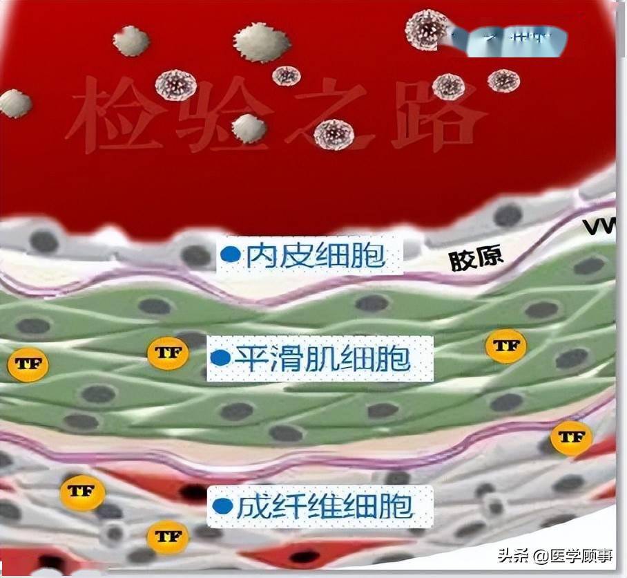 血管壁分三层,由外到内分别有成纤维细胞,平滑肌细胞,内皮细胞