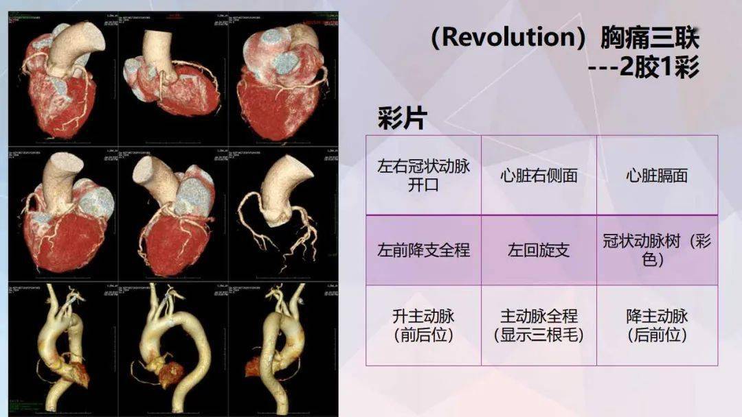 冠脉及胸痛三联cta重建规范及报告模板