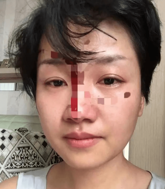 5月31日,李辉曾在其公开平台发声表示:唐萍所述为失实言论,已经对其