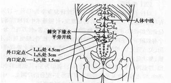 棘突 横突 体表定位