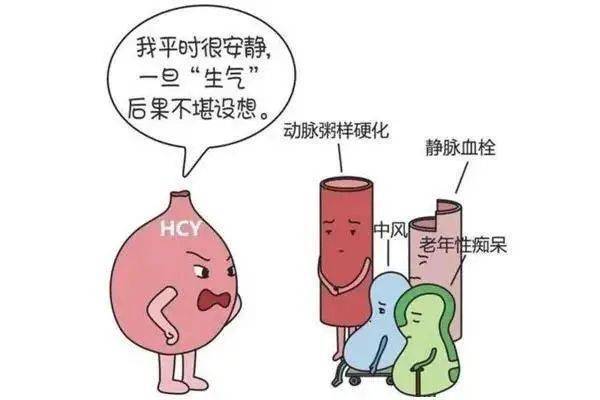 健康体检70|体检时记得验"同型半胱氨酸",它很重要!_管理_hcy_中心