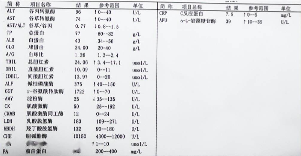 如何初步自我判断肝功能化验单教你一个方法只需要看懂3点