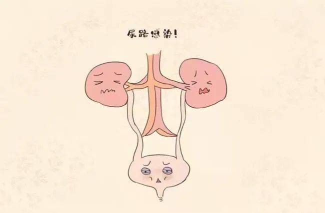 尿频尿急尿痛怎么回事？