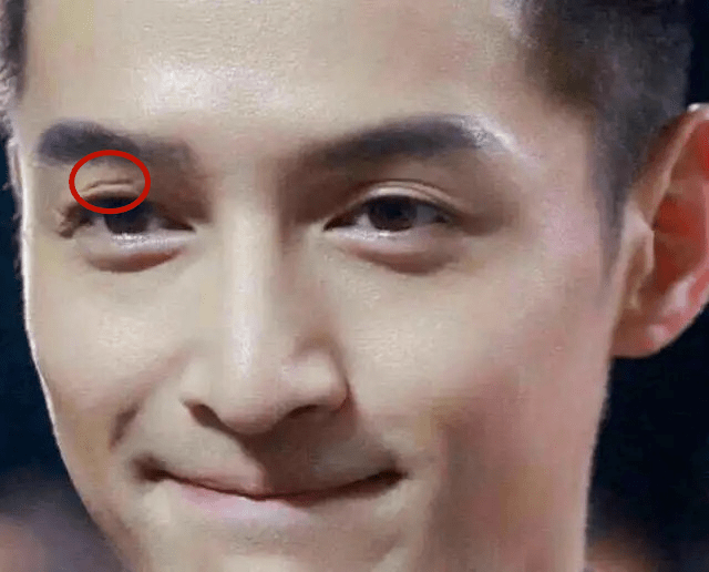 杨幂录制《密室逃脱》眼部受伤缝针,网友:"难道要毁容?