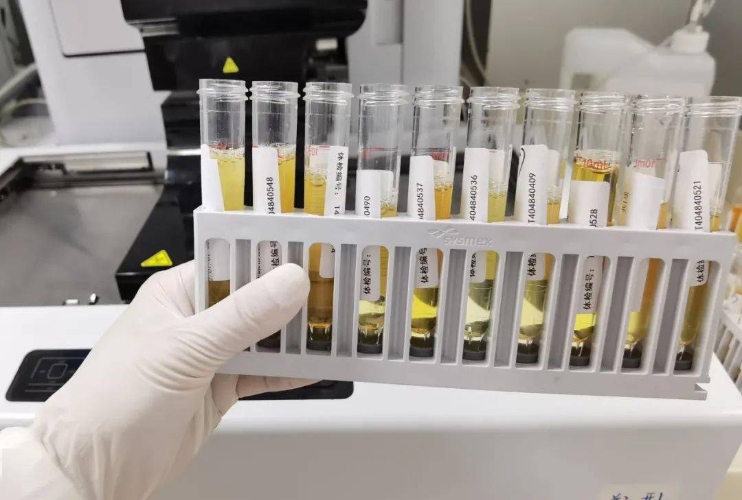 如何获取一份合格的大小便标本?很多人做错了_尿液_影响_粪便