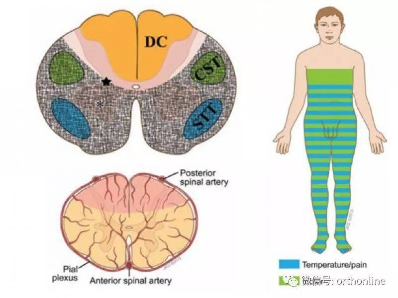 一文讀懂脊髓的解剖和定位診斷_病變_感覺_丘腦