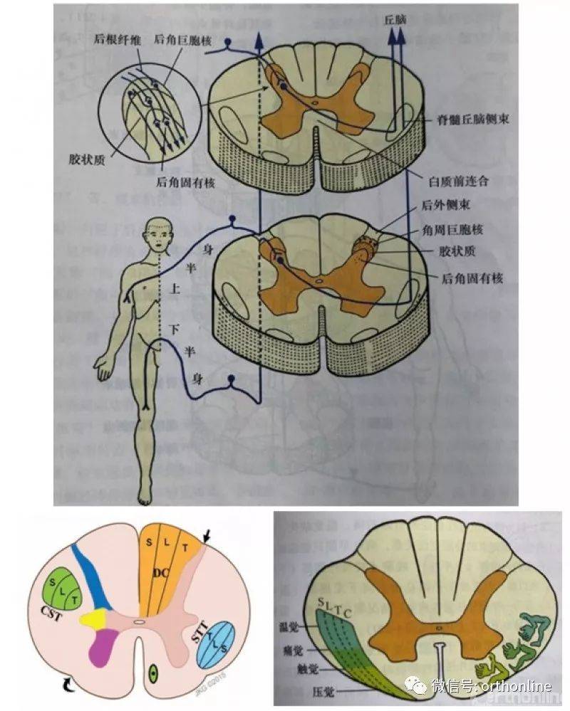 脊髓丘腦束--側束脊髓上行傳導束包括:脊髓丘腦束(側束,前束);後索