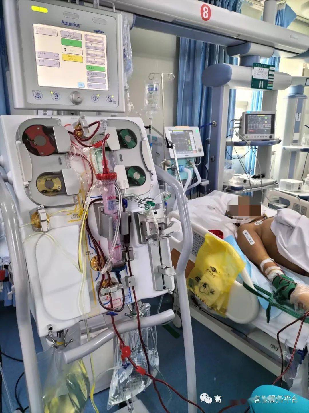 高阳县医院61人民至上多科联合成功开展4例床旁血滤技术为重症患者