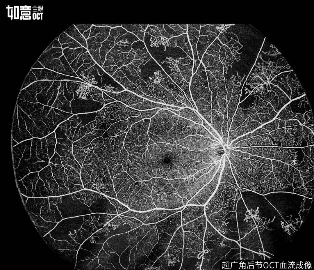 全眼轴可视化生物测量与oct完美融合视微如意全眼oct新技术发布