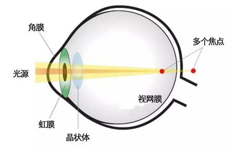 在光感應的過程中,外界光能在視網膜上的視杆視,錐細胞中引起變化