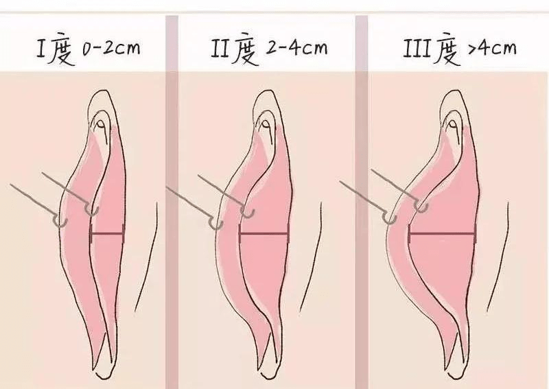 私密花园不好看,甜蜜时刻好难为情……_理想_cm_女性