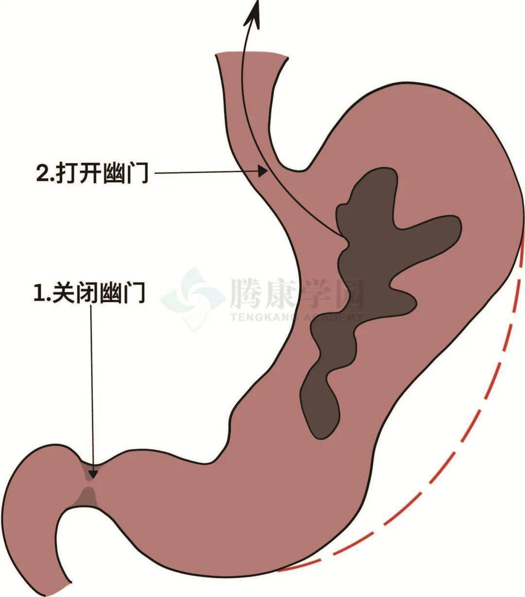 内脏与疼痛 胃的运动