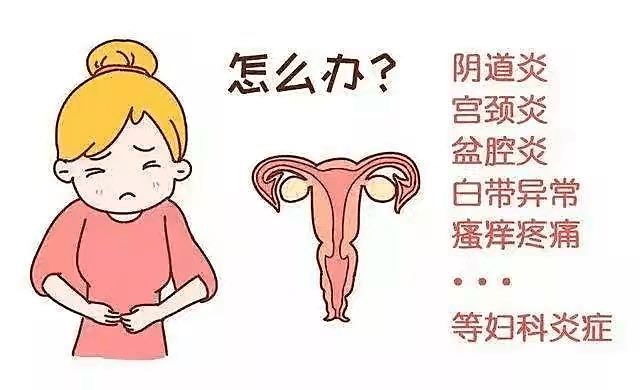 【健康宅家】女性居家如何进行妇科炎症调理