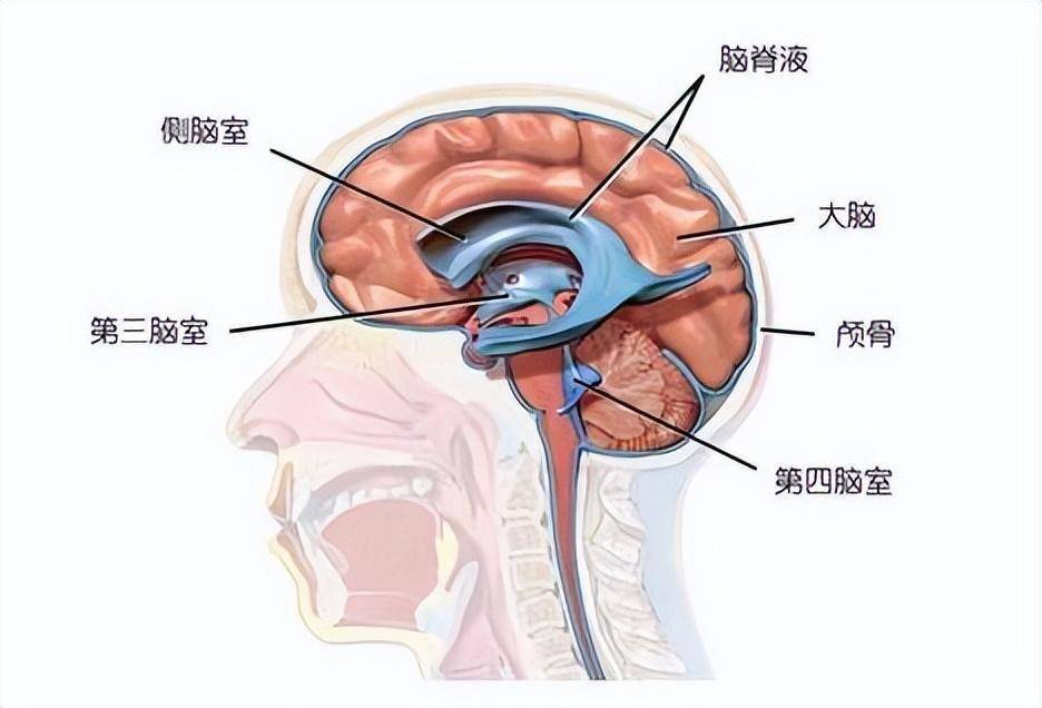 你以为的老年痴呆很可能只是“脑子进水”——常压性脑积水