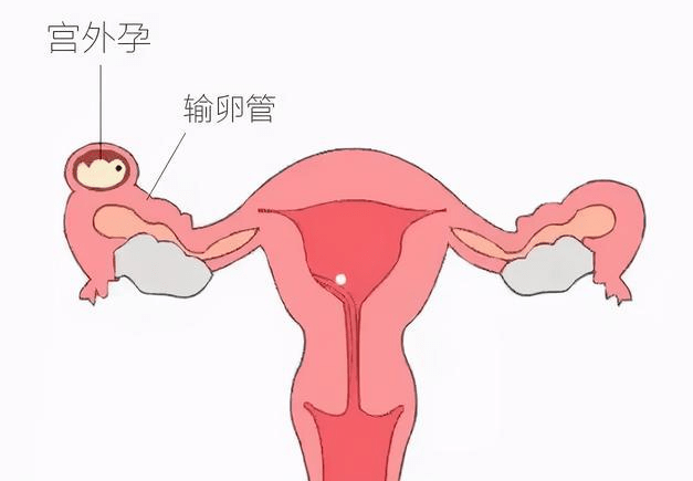 输卵管在肚脐什么位置图片
