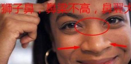 第三种,狮子鼻一般鼻梁宽大,鼻翼也大的鼻子叫做"狮子鼻.