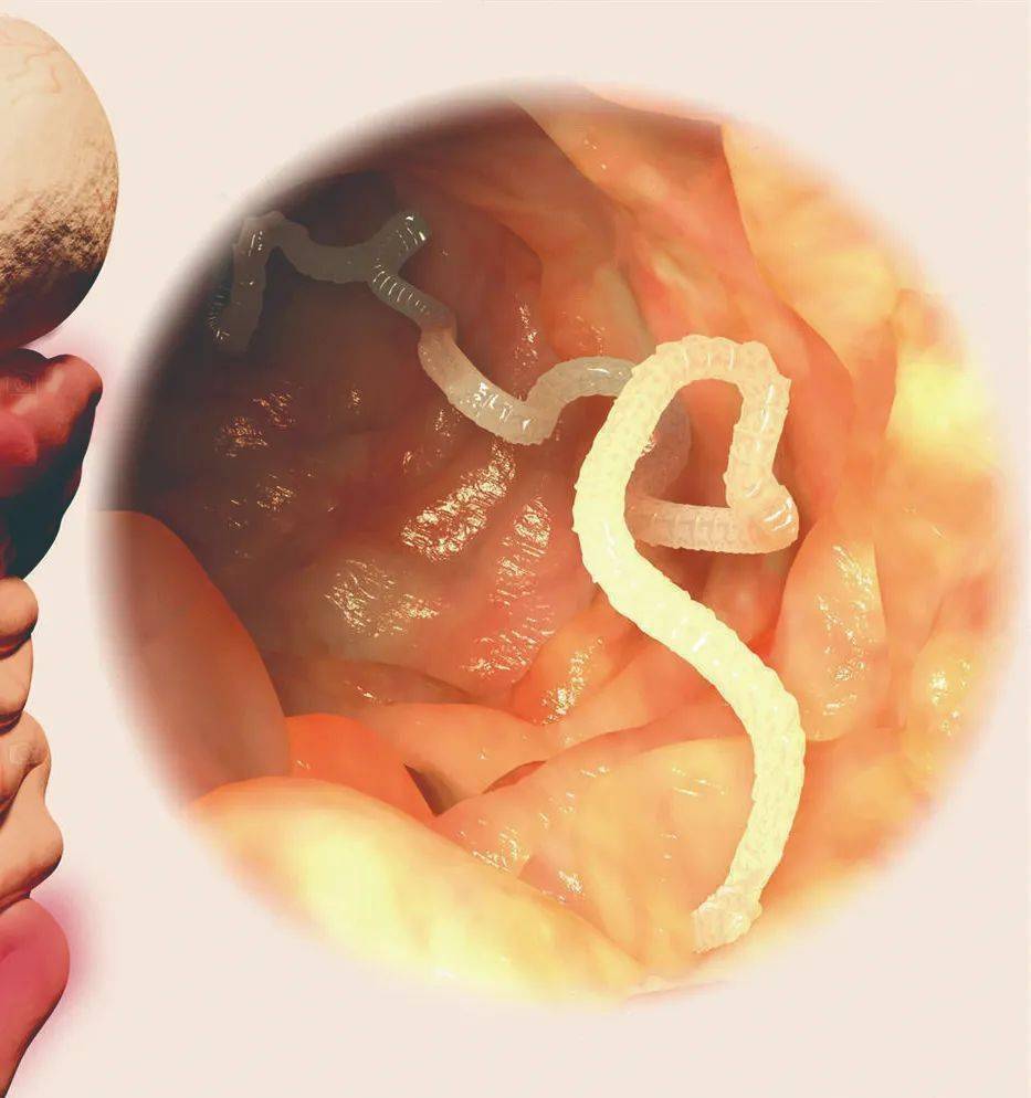 生鱼片_寄生虫_动物