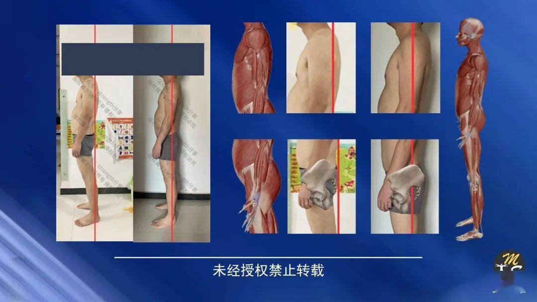 为什么杨达疗法会在康复界广为流传?_交叉_训练_扬达