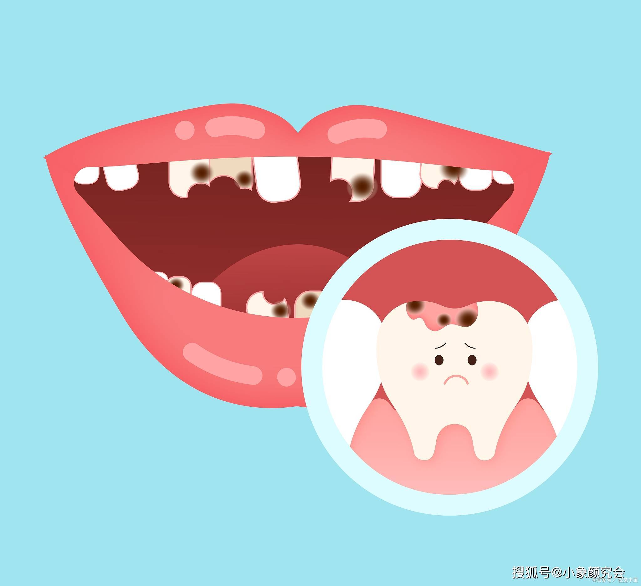 牙齿_口腔_食物残渣