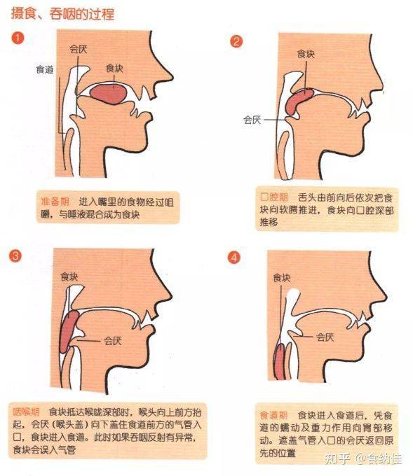 老年人吞咽障碍进食的一些方法和注意事项